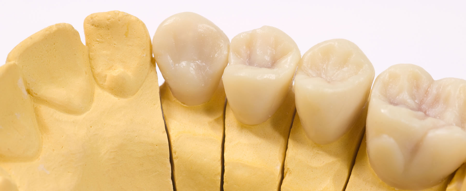 Анатомическая форма зубов