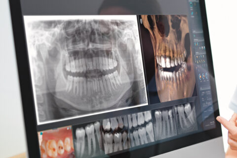 Dr. Zieger Leistungen 3D Röntgen