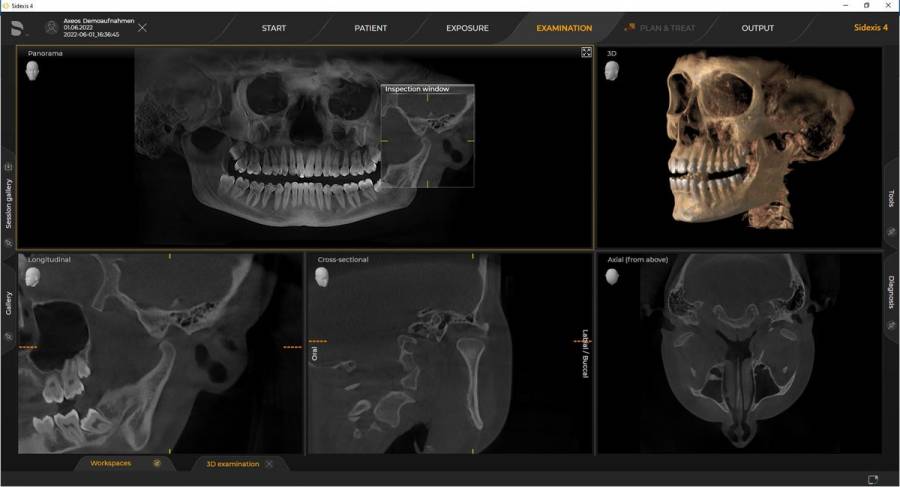 Dr. Zieger Zahnarzt Praxis Bonn Beuel 3D Röntgen DVT